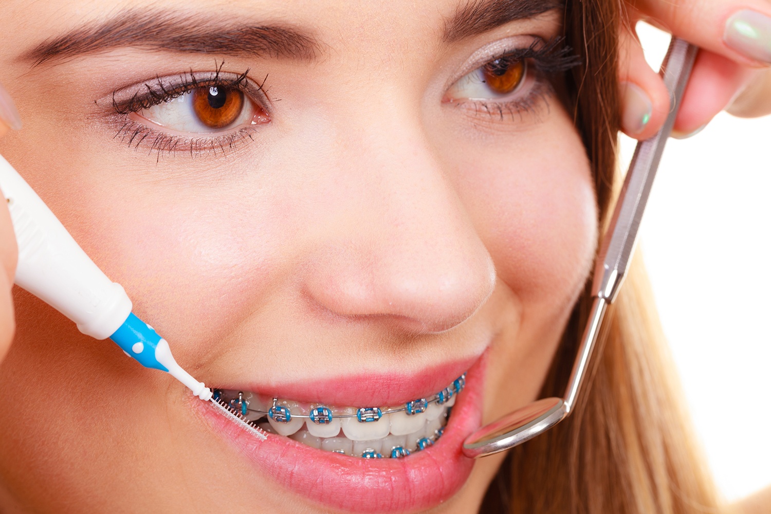 What To Do Once Your Braces Come Off
