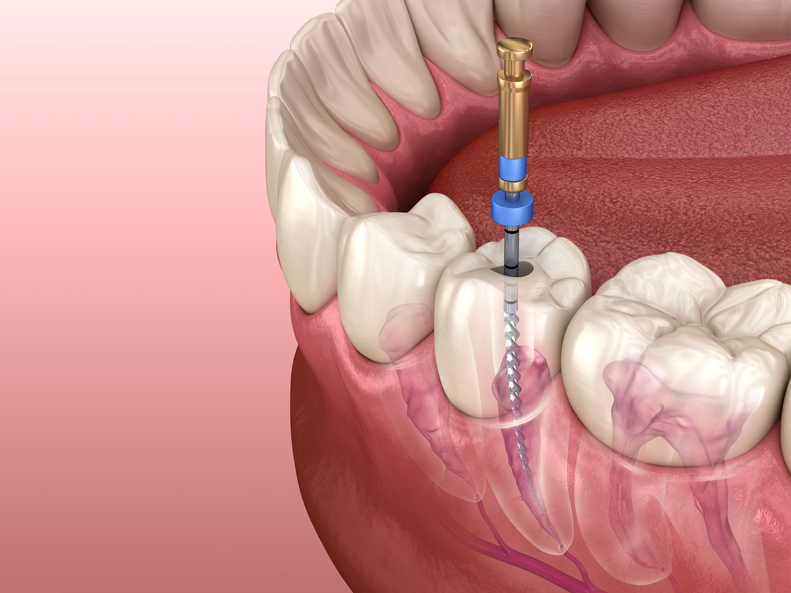 Can a Tooth Infection Spread To Your Lungs?