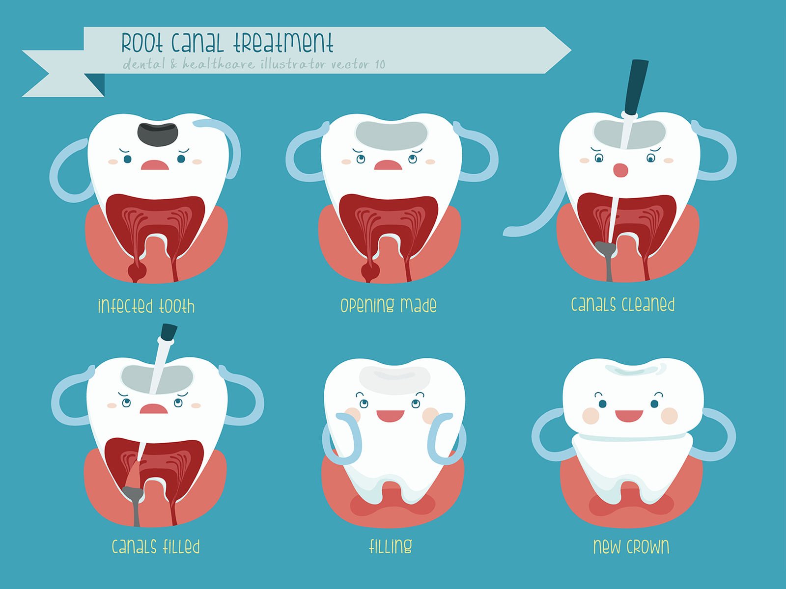 Can You Brush Your Teeth After a Root Canal?