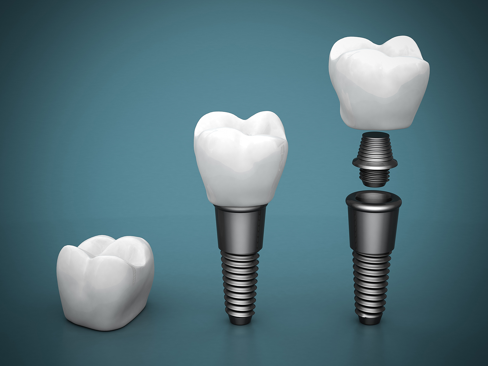 What is the difference between healing abutment and cover screw?