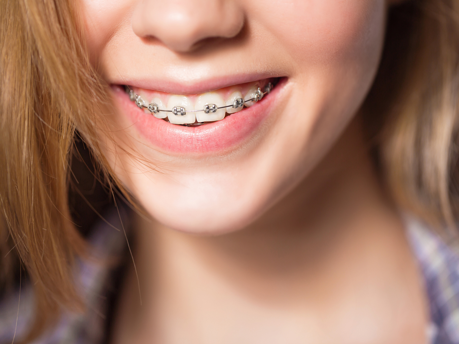 What can you eat, not eat with braces?