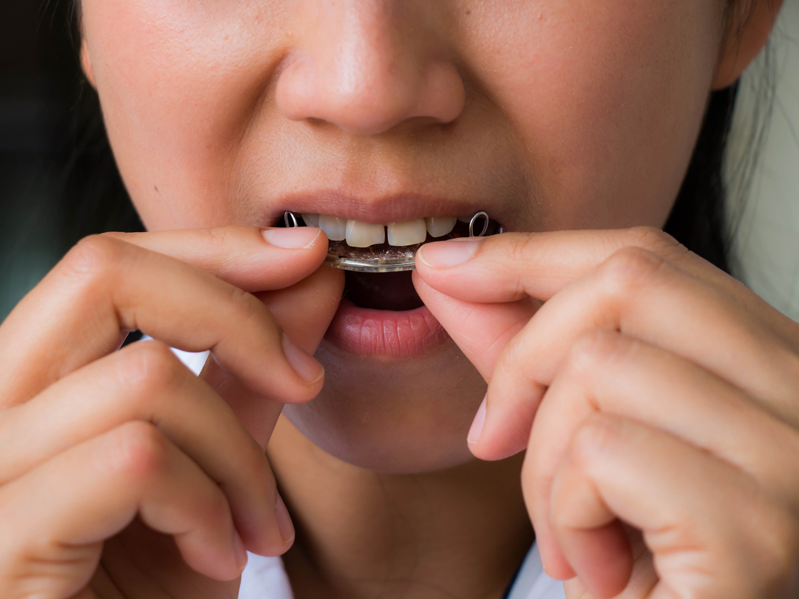 Should I brush my teeth before putting my retainer in?