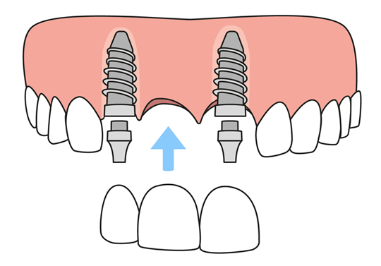 78211 TX Dentist