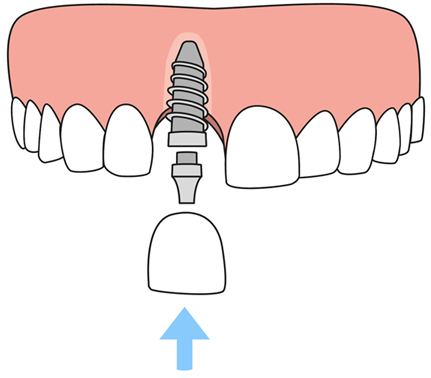 Dentist in 78211 TX