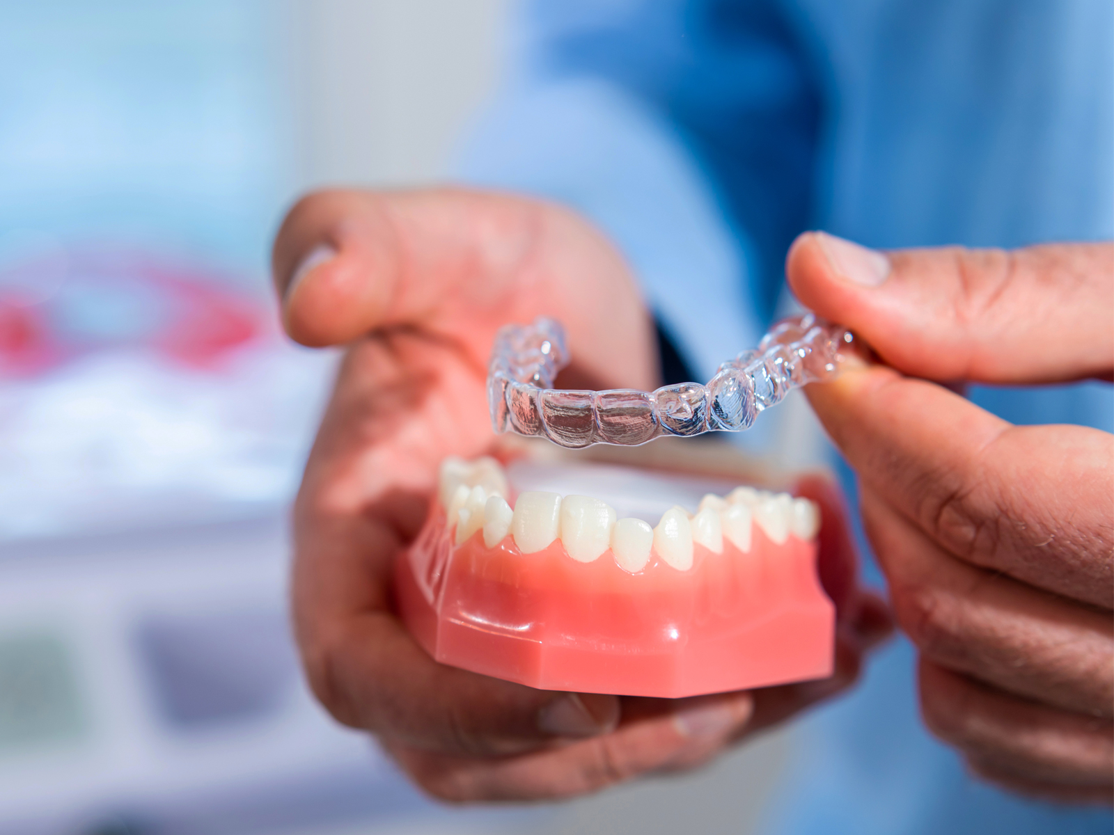 Top 5 Benefits of Invisalign