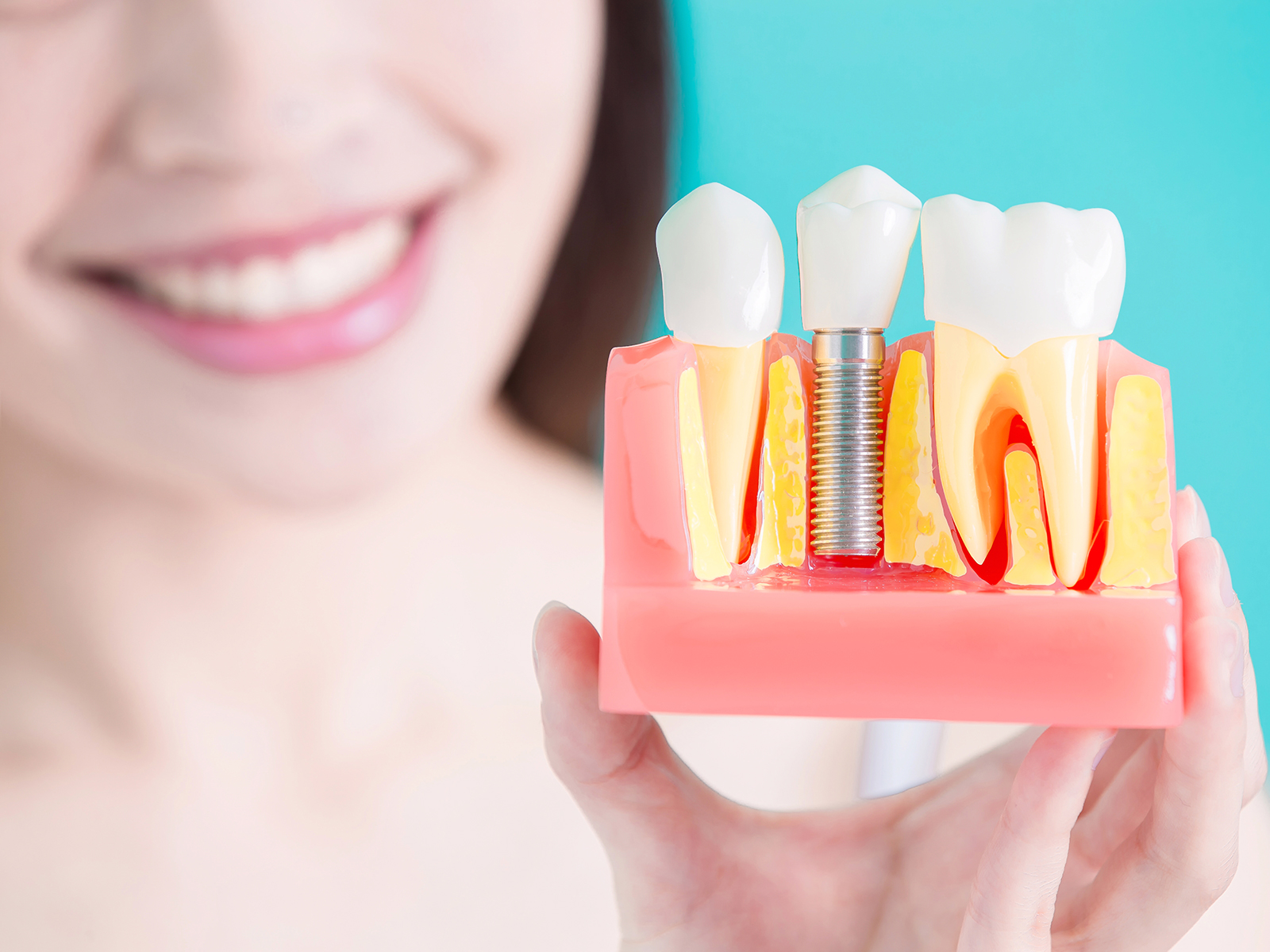 What are the most common causes of dental implant failure?