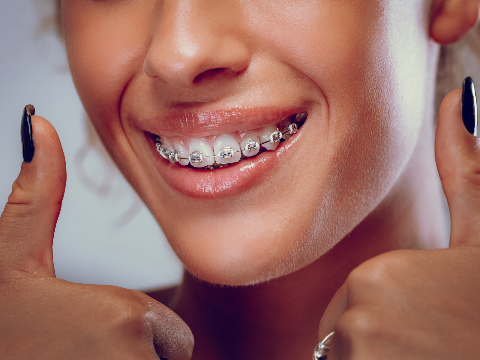 Why You Need To Choose Advanced Orthodontics?