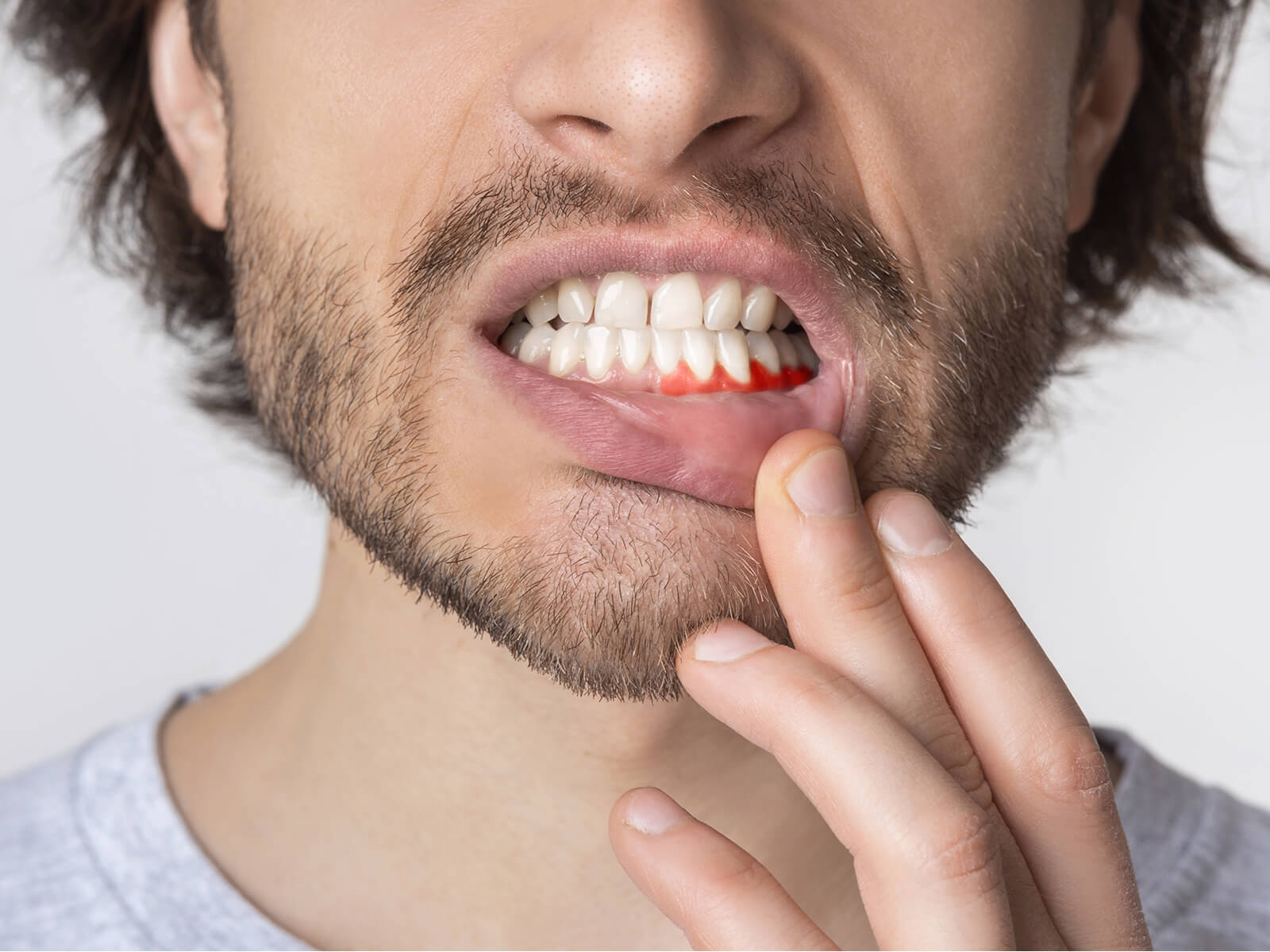 The Surprising Link Between Gum Disease And Heart Health