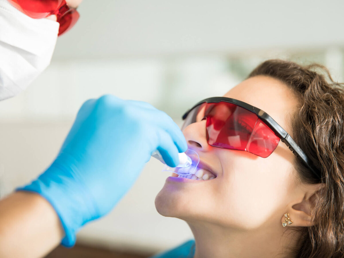 Everything You Need To Know About GLO Professional Teeth Whitening