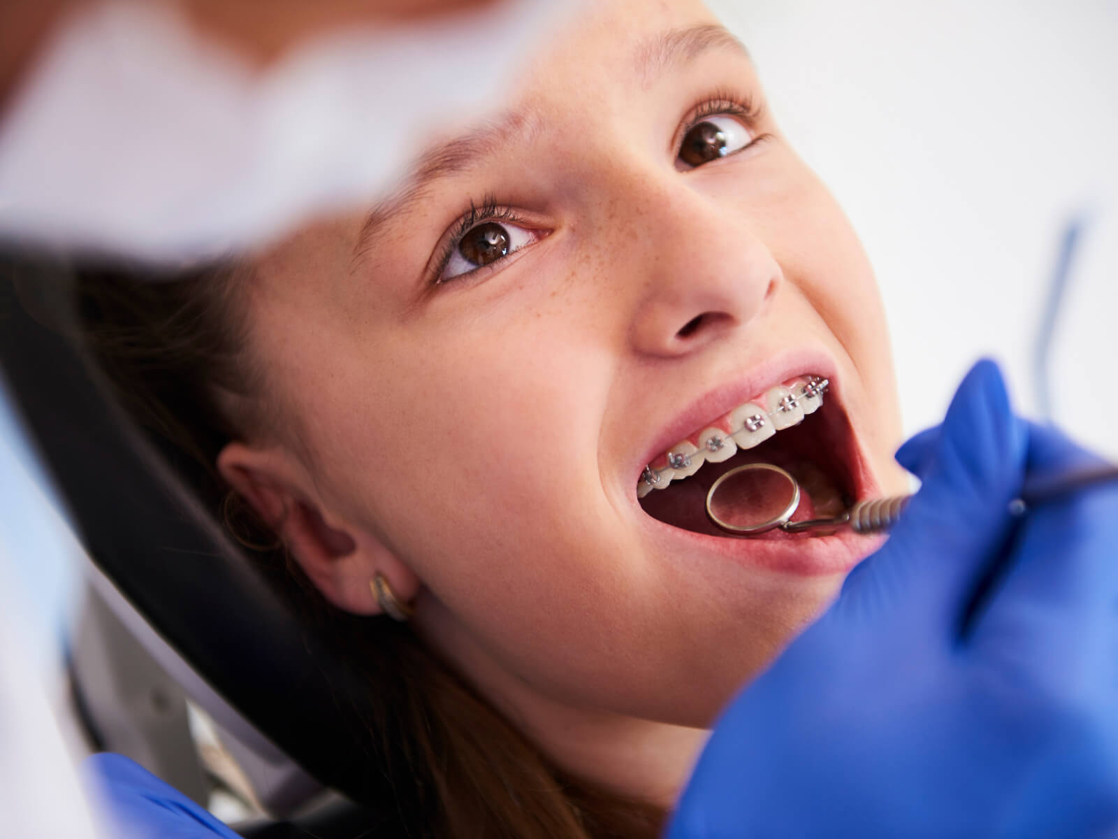 How To Improve Gum Health And Prevent Dark Spots