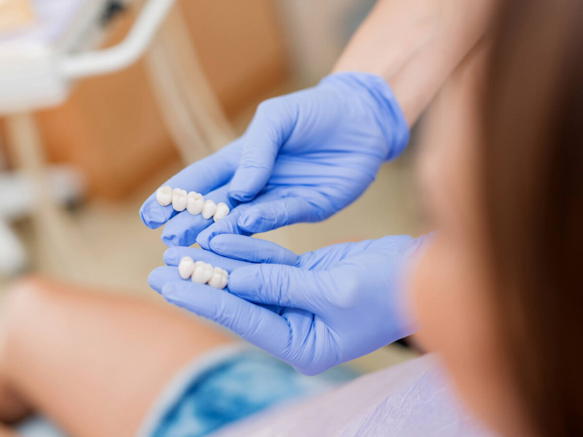 Types of Dental Crowns: Which One Is Right for You?