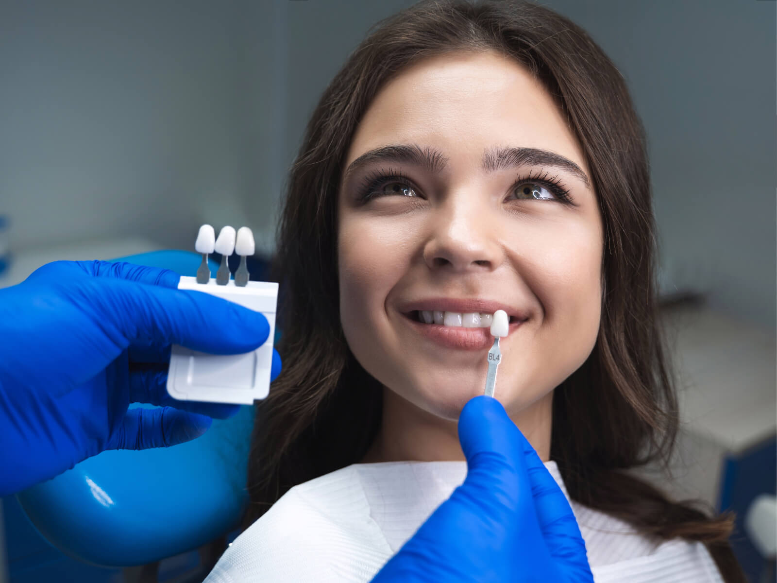 What Are Snap-On Veneers And How Do They Work?
