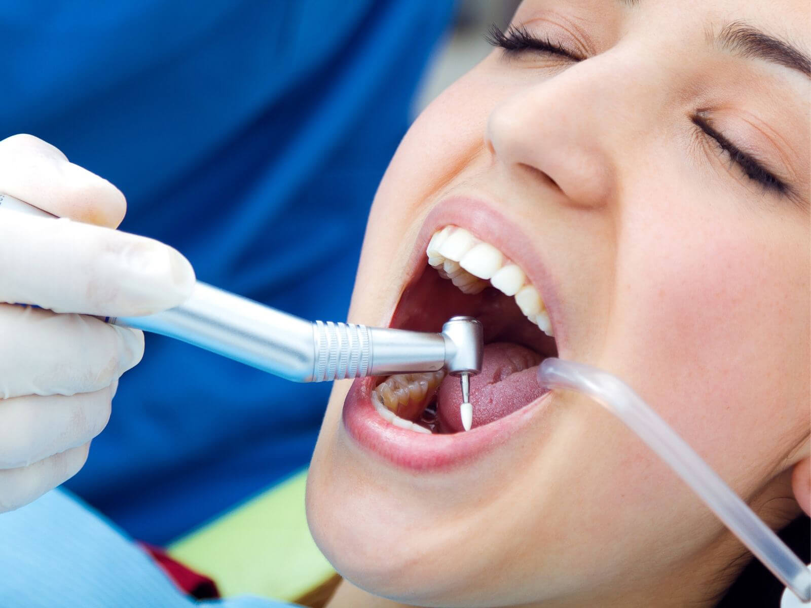 What Is A Pulpotomy, And When Is It Needed?