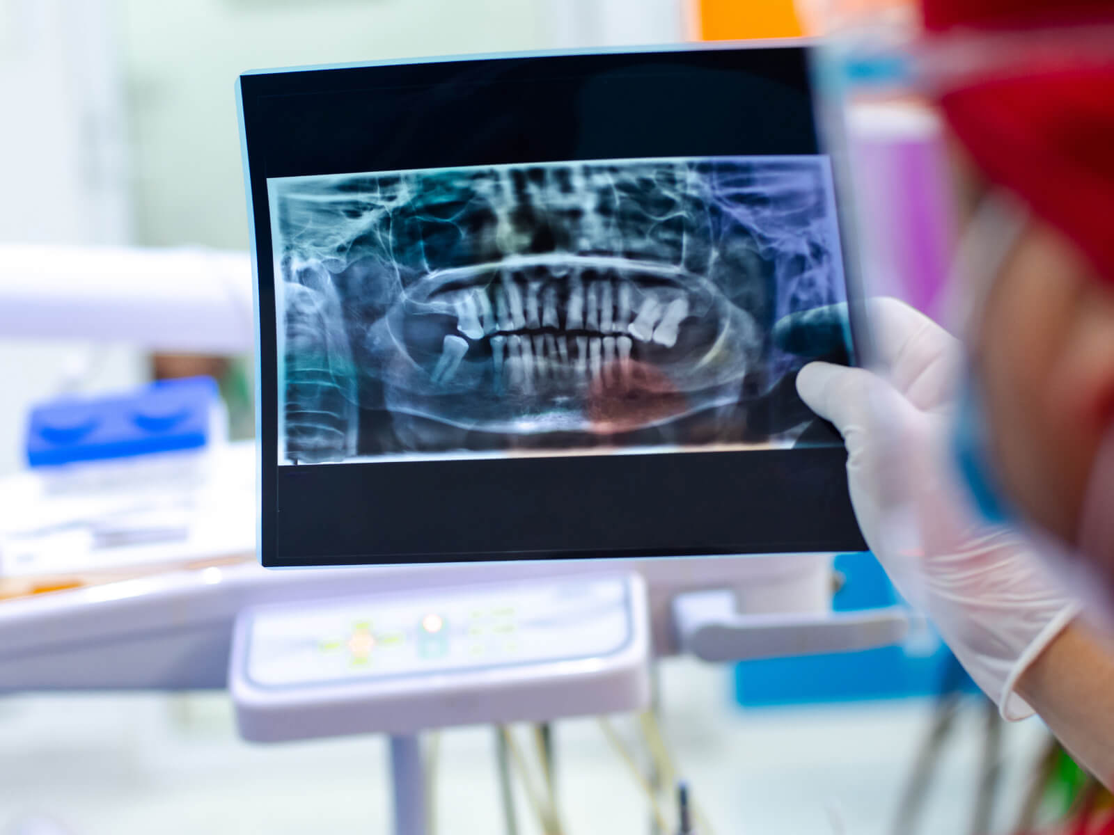 Mini Dental Implants: Are They Worth It For Small Gaps?