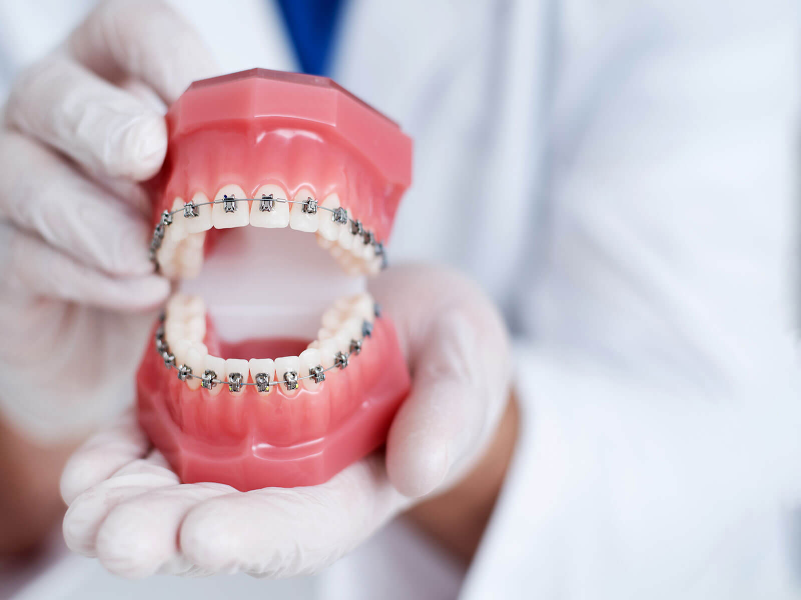 How Much Do Braces Cost at Riverwalk Dental & Orthodontics