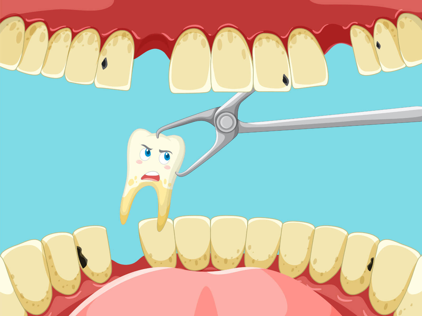 Same-Day Tooth Extraction and Implant: Is It Possible?
