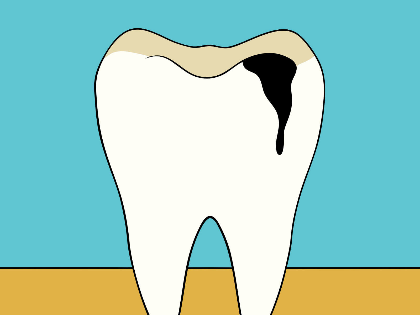 Dental Crown Procedure: Step-by-Step Guide