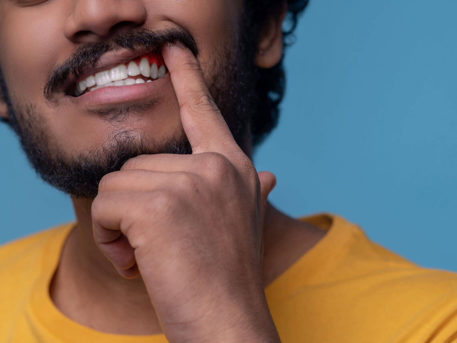 How to Stop Bleeding Gums: Home Remedies and Professional Care