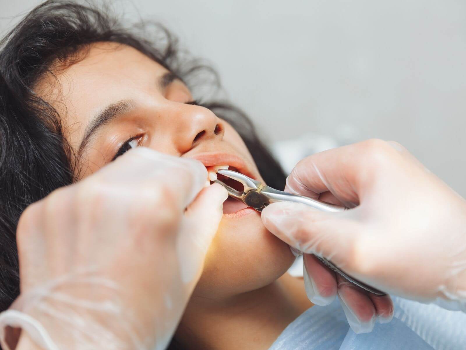 Root Canal vs. Tooth Extraction: Cost, Pain, and Which Is Better