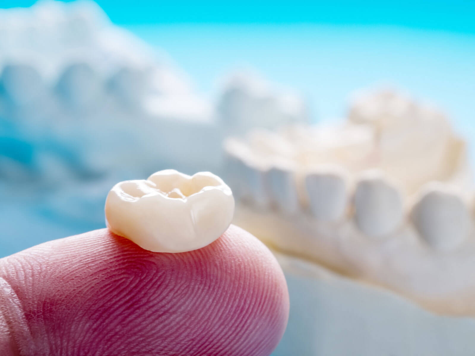 Dental Crown Cost in 2026: Prices by Material, Insurance, and Financing