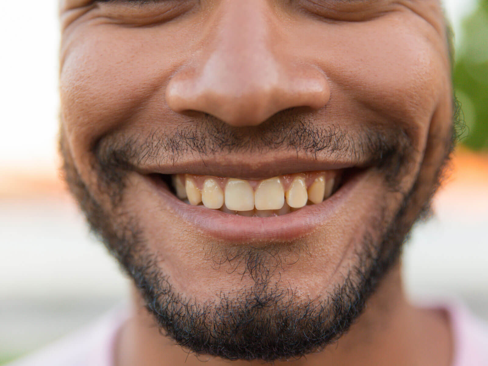 What Causes Teeth Crowding? Common Reasons Explained